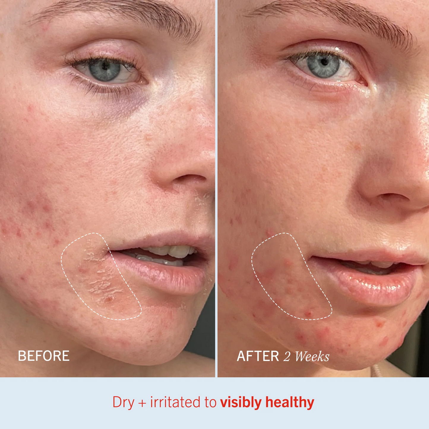 Ultra Repair Cream Intense Hydration