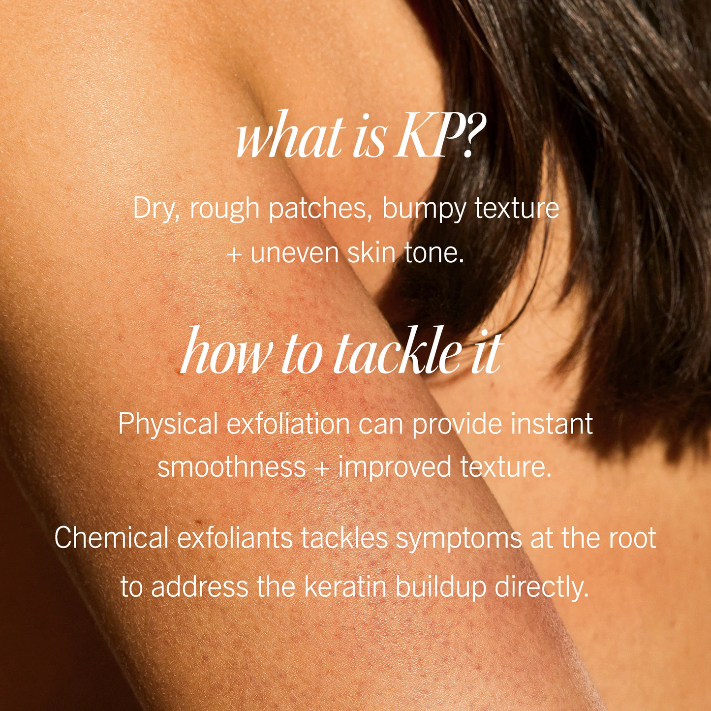 KP Bump Eraser Body Scrub 10% AHA