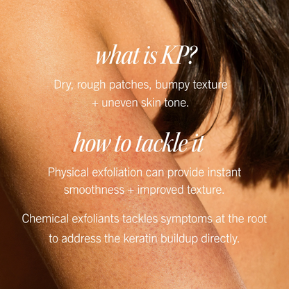 KP Bump Eraser Body Scrub 10% AHA